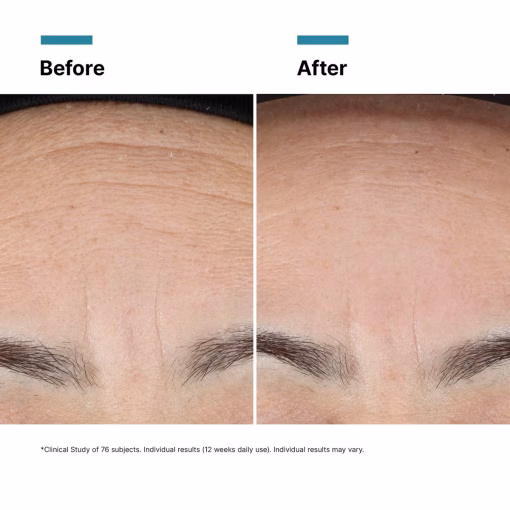 Nyhet kommer snart Skinceuticals Advanced RGN-6 - Bild 10