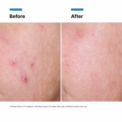 Nyhet kommer snart Skinceuticals Advanced RGN-6 - Bild 11
